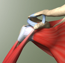 Graphic image of tendons in a shoulder.
